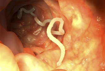 Tapeworm Symptoms, Transmission and Prevention